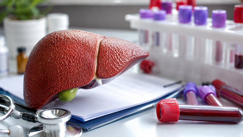 Brasil amplia ações contra as hepatites virais: por que a campanha Julho Amarelo importa e quem deve fazer o teste